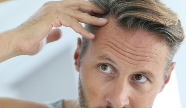 hair loss 7